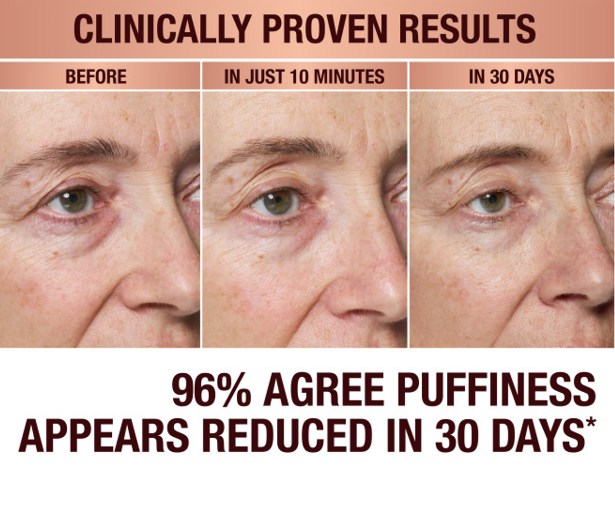 CHARLOTTE'S HOLLYWOOD SKIN SECRETS IMMEDIATE EYE REVIVAL PATCHES - Charlotte Tilbury