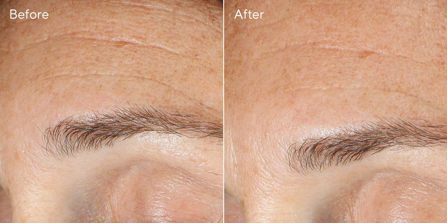 Murad Peeling Multi-Acides Régénérant 100ml